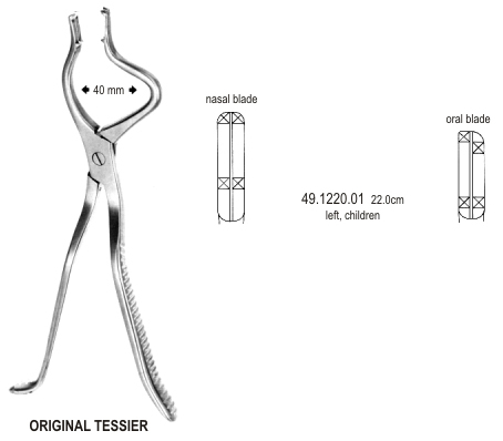 Tessier Disimpaction Fcps left child 22cm